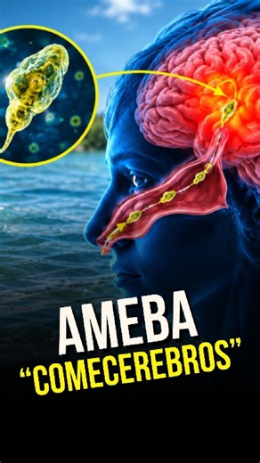 ALERTA SANITARIA 🧠🦠 Qué es la AMEBA "COMECEREBROS" y cómo prevenirla