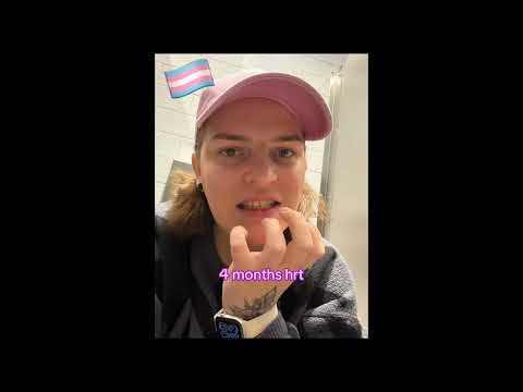 Male to Female Transformation | 6 Months of Change | MTF Transition: 6 Months of Growth,p