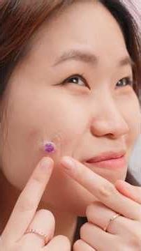 Would You Pop a Magic Pimple?