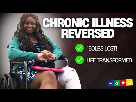 She Lost 160 lbs and Reversed 15 Chronic Illnesses