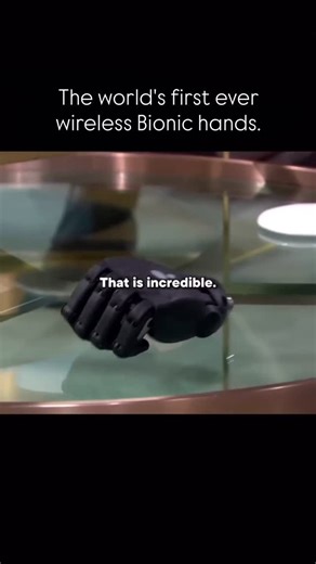 Gustavo | Elite Mindset on Instagram: "A 19-year-old named Tilly Lockey is a notable example of a girl with advanced bionic hands, which are 3D-printed by Open Bionics. These bionic hands, called the Hero Pro, are muscle-operated and controlled by the user’s thoughts, allowing for complex grips, 360° wrist rotation, and even wireless operation when detached from the arm. Lockey was integral to the development of these hands and uses them to show that a limb difference is a source of strength, wi