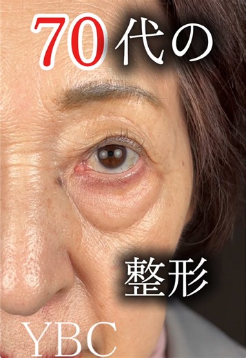 クマ治療の専門医が教える！切らない施術の魅力