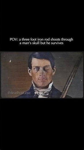 The Phineas Gage Incident