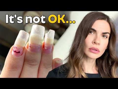 Why This Finger Got Rejected by a Salon
