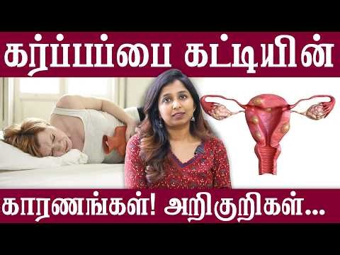 கர்ப்பப்பை கட்டியின் காரணங்கள்! அறிகுறிகள்... | #daisyhospital #drsharmika #tdaisy