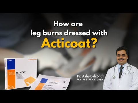 Leg Burn Wound Dressing Explained | Acticoat Silver Dressing for Safer Healing | #legburn #dressing