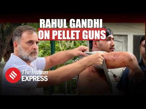 Rahul Gandhi Questions Delhi Police Action Over Sahil’s Alleged Pellet Gun Injury