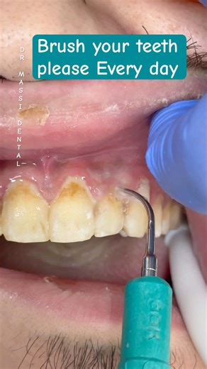 Oral Hygiene Tips , Smile