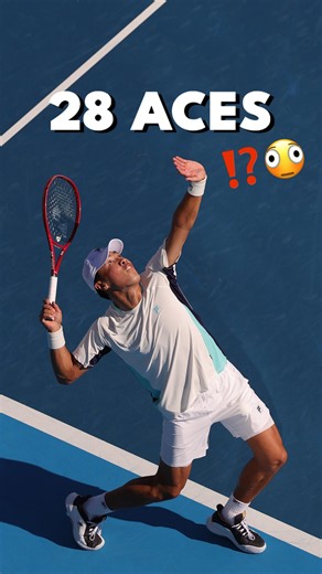 Serving Clinic 💥
