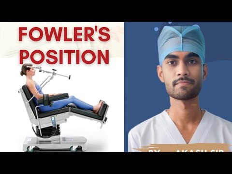 आज हम सीखेंगे ओट में Fowler's position kaise bnaye हैं ।।।। #surgical #position #FowlersPosition