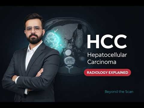 The Radiology of HCC: A Structured Approach to Diagnosis