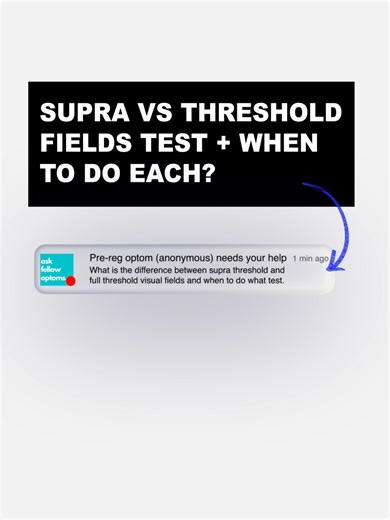 What's the difference between supra-threshold and full-threshold visual fields and when should you use each test? Optometrists clarifies on the Ask Fellow Optoms app that full threshold provides detailed numerical data for quantitative analysis, useful for detecting subtle defects, while supra-threshold serves as a screening tool, providing a pass/fail result for generalized defects. So what are the key lessons? Firstly, full threshold visual fields are better for suspecting glaucoma due to its 