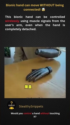 Bionic Hand Can Move Without Being Connected! 🤯 #shorts