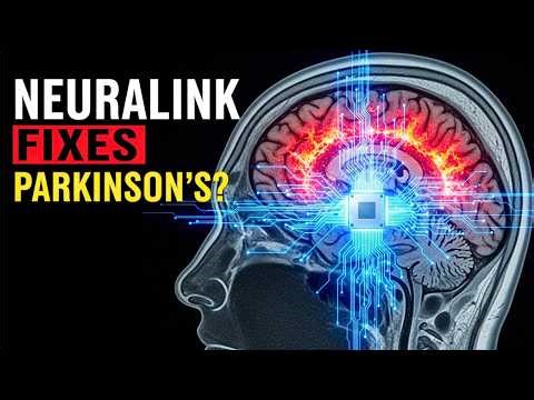 Neuralink vs. Parkinson's: The End of Pills? (2025 Update)