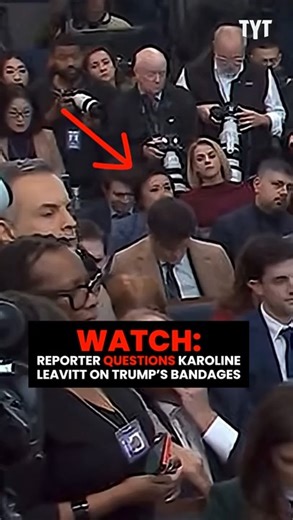 "The President's Been Spotted Out And About A Number Of Times With BANDAGES On His Hands..." | The Young Turks