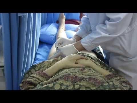 Medical Acupuncture Learning from Shifang Institute of Traditional Chinese Medicine Shifang Chengdu