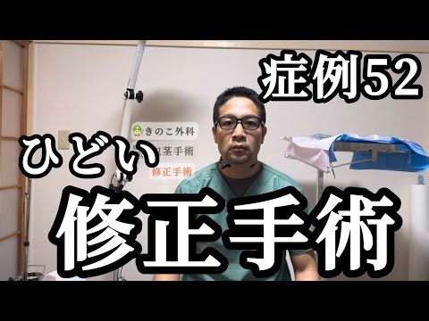 【症例52】大手の3万の手術とは。。。