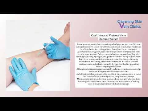 Charming Skin Vein Clinics (Oakbrook) - Can Varicose Veins Go Away Without Medical Treatment?