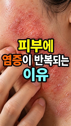 피부에 염증이 반복되는 이유