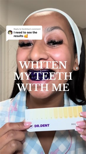 Whitening Your Teeth at Home: Effective Tips