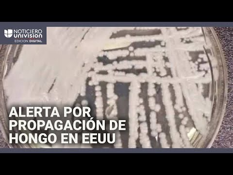 Un hongo mortal y resistente a medicamentos se propaga con rapidez en EEUU: hay 27 estados afectados