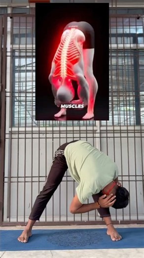 🔥 Lower Back Pain & Sciatica? Try These Exercises! #shorts