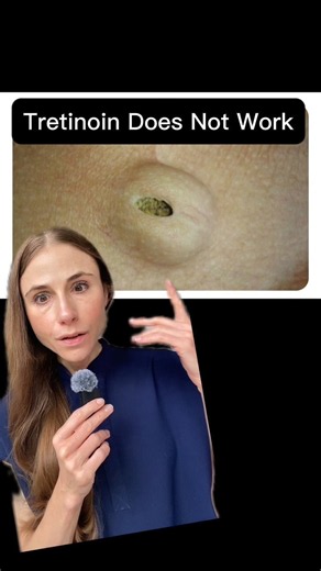 Your Tretinoin Is Doing NOTHING! 😳