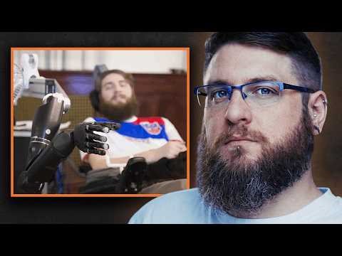 I Got a Brain Implant to Control a Robot Arm