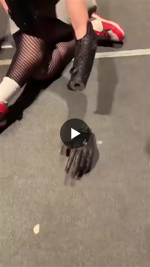 Angel Giuffria demos Atom Touch bionic arm with magnetic attachment | AI Insights Daily posted on the topic | LinkedIn