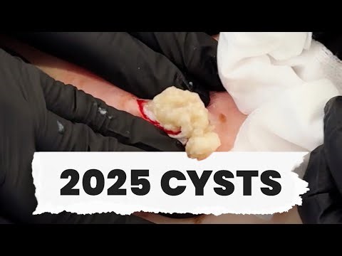 2025 CYSTS - YEAR IN REVIEW!