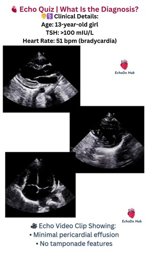 Echo Quiz | What Is the Diagnosis? #heartdisease #echocardiography #cardiologyeducation