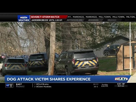 Police fatally shoot 2 dogs that left 3 people injured after attack