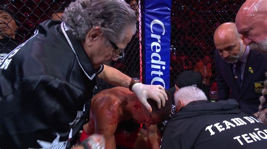 Nate Diaz’s corner just waived off the fight against Mike PerryHe was a mess 😳🩸
