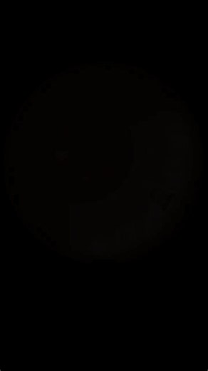 #ophthalmology #retinasurgery #vitrectomy #vitreoretinalsurgery #eyecareindia #healthcareindia #doctorsofindia #mededindia #ophthalmologist #retinaldetachment #medicalanimation #surgerylifeindia… | BASANT KUMAR