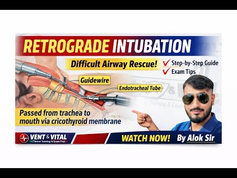 Retrograde Intubation | Advanced Airway Management | Vent & Vital Simplified | Learn with Alok Sir