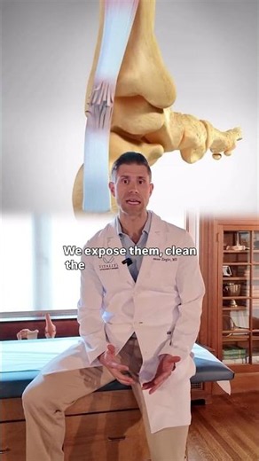 How an Achilles Rupture Repair Actually Works #orthopedicsurgeon #regenerativemedicine #doctor