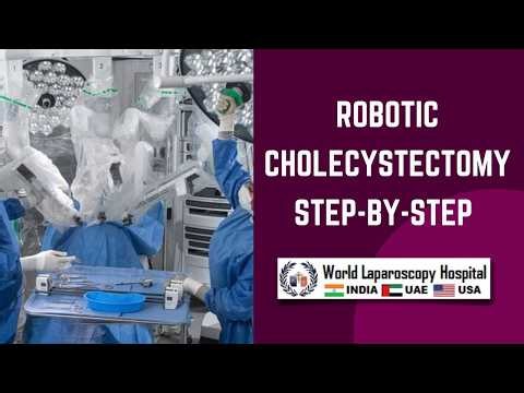 Robotic Cholecystectomy Step-by-Step | Gallbladder Removal Surgery Using Robotic Technology | WLH