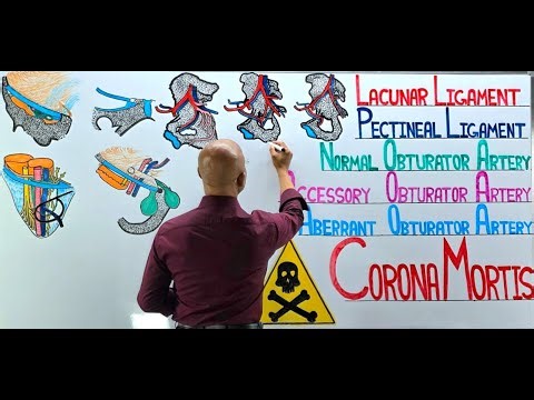 Lacunar and Pectineal Ligament, Femoral Hernia Strangulation and Corona Mortis | Anatomy