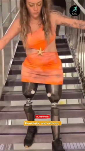 Amputee Girl Above Knee 💫 | No Legs, No Limits | Walking with Unstoppable Confidence #inspiration