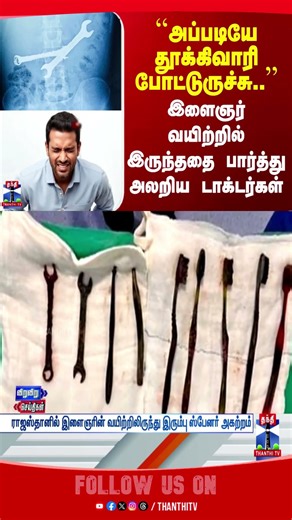 spanner | doctors | patient | rajasthan