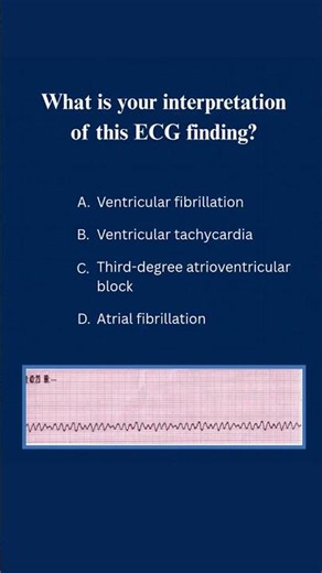 Question of the Day | Can you read this ECG? #acls #aclscertification #shorts