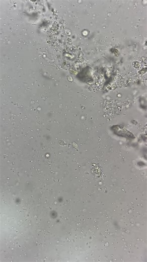 Microscopic Examination Techniques in Short Video