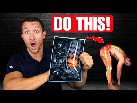 What Exercises Should You Do Based on Your MRI? | Low Back Pain