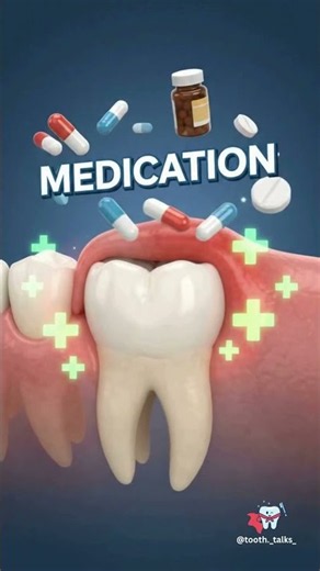 Pericoronitis Treatment| How to Treat Wisdom Tooth Infection | #Shorts