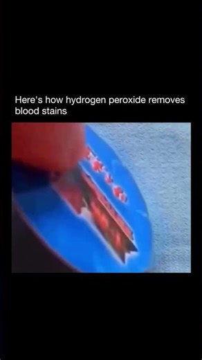Why Hydrogen Peroxide Bubbles on Blood 😳 #shorts#science #chemistry #hydrogenperoxide #cleaning#fyp