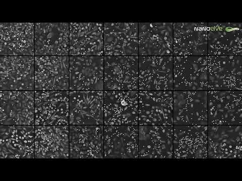 𝗪𝗵𝗶𝗰𝗵 𝘄𝗼𝗿𝗸𝗳𝗹𝗼𝘄 𝘄𝗶𝗹𝗹 𝘆𝗼𝘂 𝗱𝗲-𝗿𝗶𝘀𝗸 𝗶𝗻 𝟮𝟬𝟮𝟲?