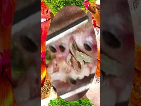 Blackheads Removal #264 | Acne Treatment and Very Satisfying Satisfying Pimple pop #blackheads