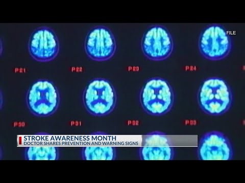 How to spot a stroke: Prevention and warning signs from a doctor | 17 News at Sunrise