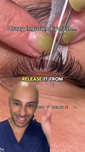 The Eyelash Mistake Everyone Makes...