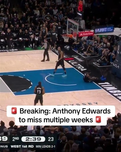 Anthony Edwards has sustained a bone bruise and hyperextension in his left knee